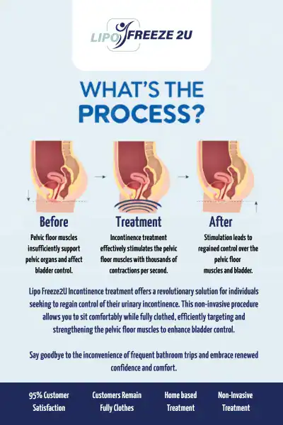 Diagram of how incontinence treatment Weybridge works.