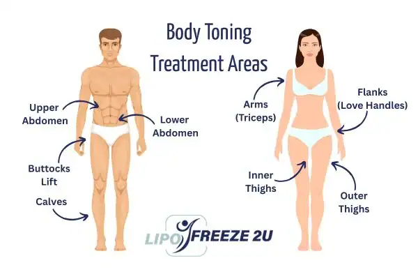 Graphic showing where you can have Body toning Treatment Weybridge on your body