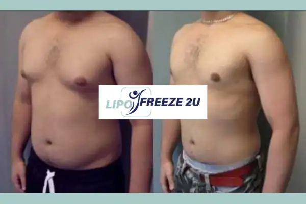 How Long Does It Take to See Results Weybridge?